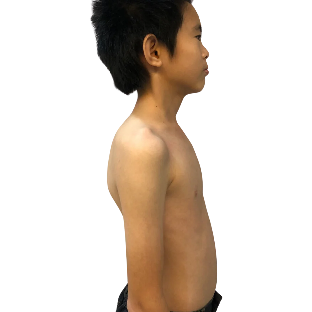 Case 09 — After