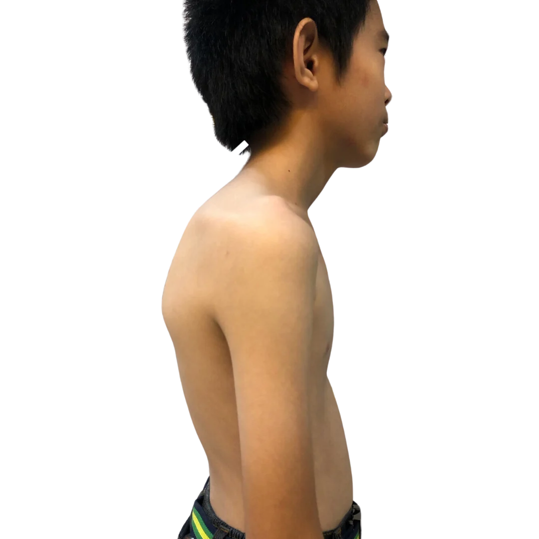 Case 09 — Before
